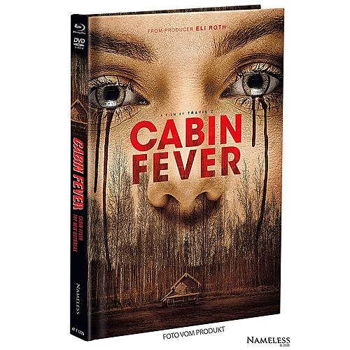 Klicke auf die Grafik für eine vergrößerte Ansicht

Name: cabin-fever-4-original.jpg
Ansichten: 110
Größe: 652,0 KB
ID: 286352